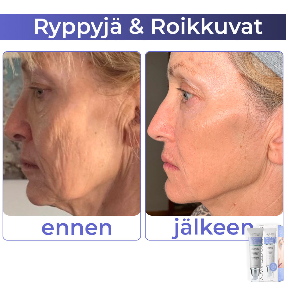 flysmus™ Advanced Collagen Complete silmänympärysvoide