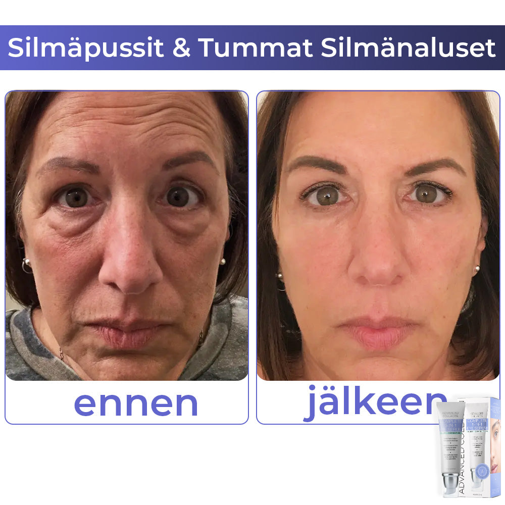 flysmus™ Advanced Collagen Complete silmänympärysvoide